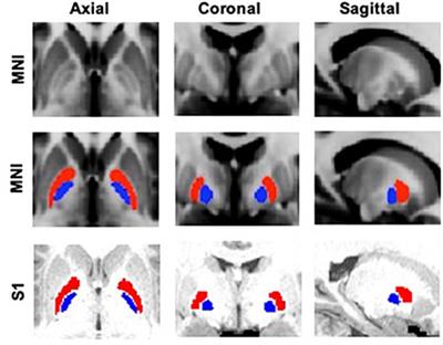 Frontiers | Cortical And Thalamic Connections Of The Human Globus ...